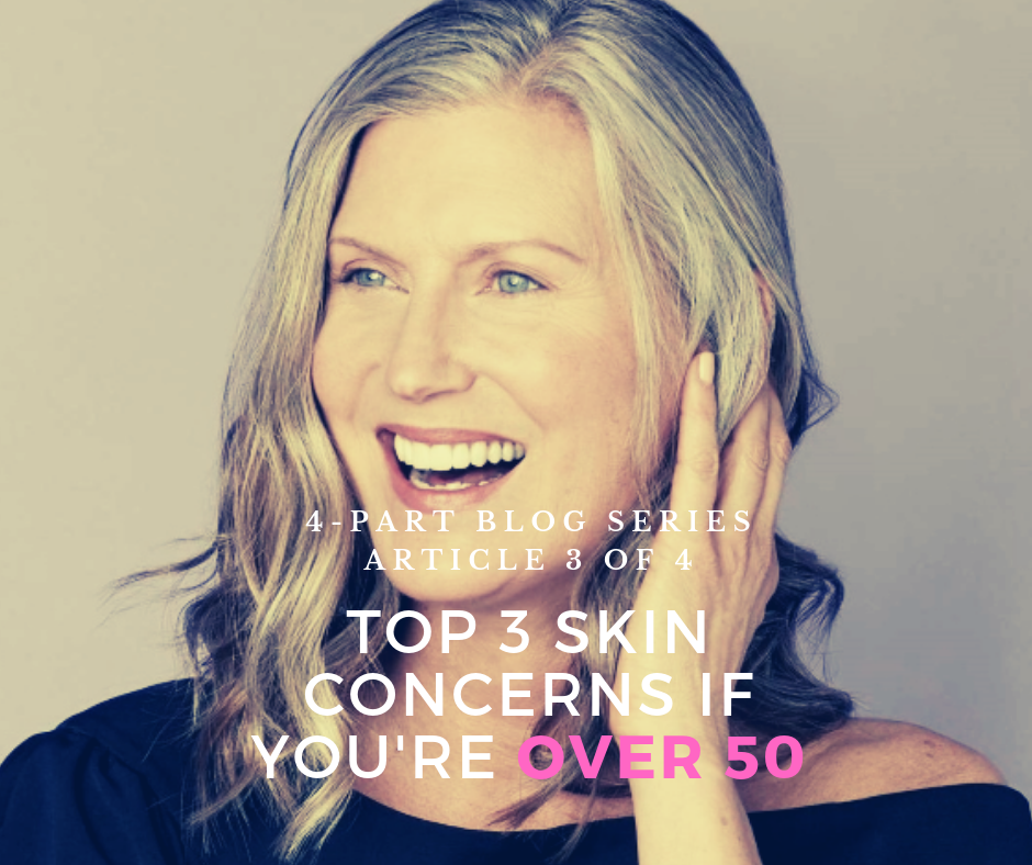 4-Part Series~Your Skin as You Age: Top 3 Skin Concerns if You’re Over 50
