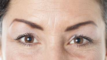 Getting rid of  wrinkles